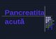 Pancreatita acuta