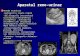 Aparatul reno-urinar Metode examinare -Radiografia renală simplă -SDC-Urografia intravenoasă (pielografia descendentă), cistografia, pielografia ascendentă