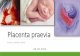 Placenta praevia - users.atw.huusers.atw.hu/drarpad/downloads/29.pdf · Definiție Placenta inseratăpe segmentul inferior al uterului avîndca unicămanifestare clinicăhemoragia