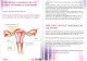 dspvs.rodspvs.ro/dsp2/images/brosura_m.pdf · Ce este cancerul de col uterin? Cancerul de col uterin este cancerul partii inferio- are a uterului, cea care face legatura cu vaginul.
