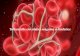 Tulburările circulației sanguine și limfatice · 2019-09-13 · Infarct miocardic acut One-day-old infarct coagulative necrosis wavy fibers Up to 3 days duration Neutrophilic infiltrate