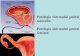 Patologia sistemului genital masculin. Patologia ... · PDF file Tema: Patologia sistemului genital masculin. Patologia sistemului genital feminine. I. Microprepatate : №227. Adenocarcinom