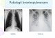 Patologii bronhopulmonare